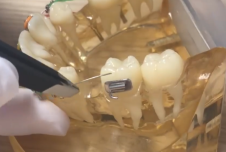 Struggling to get wire in? (cutting)