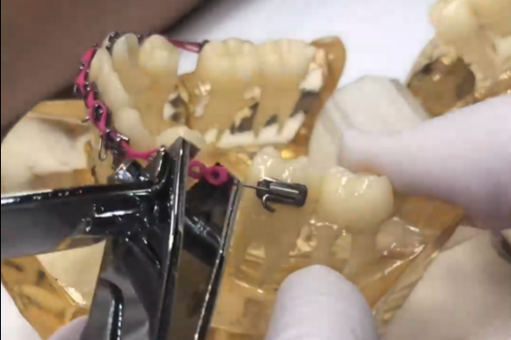 Broken or loose chain?