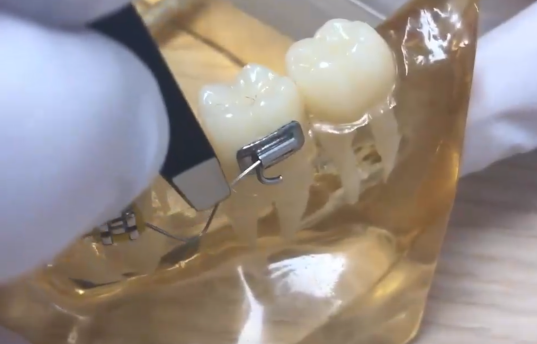 Wire popped out? (fixing)